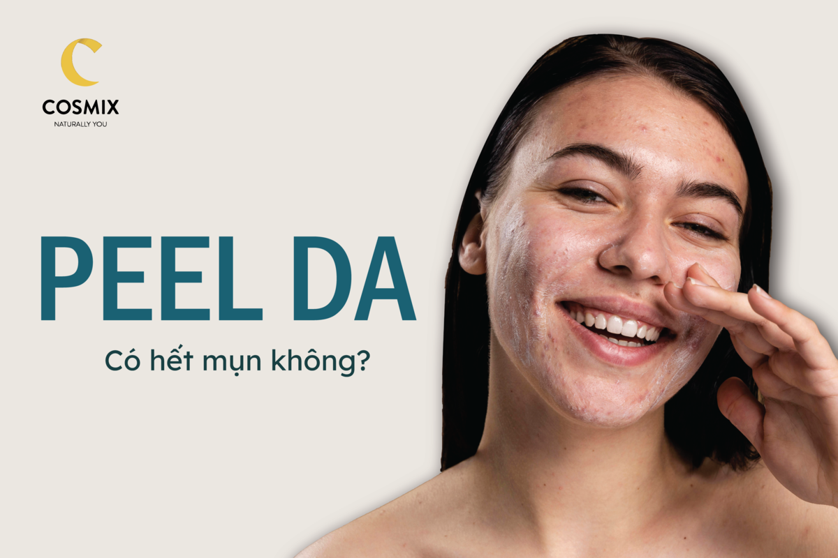 Peel da có hết mụn không? Có an toàn và hiệu quả không?